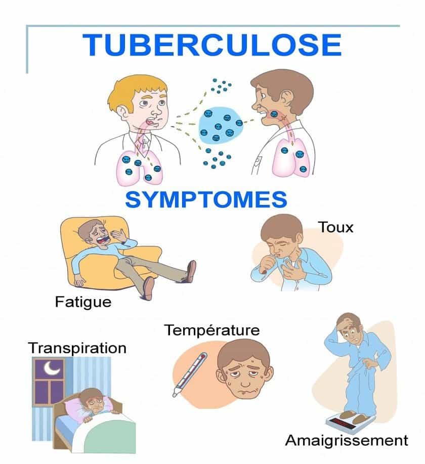 98038fbe4e7beb181adab82a5f22a98c | Québec Preppers Illustration de la tuberculose pulmonaire
